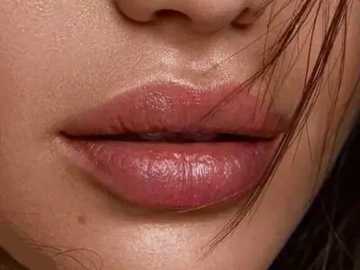 Lipfiller